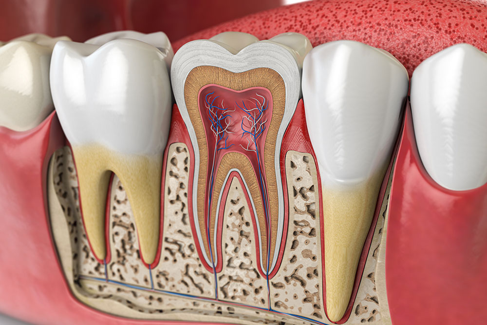 Root Canals